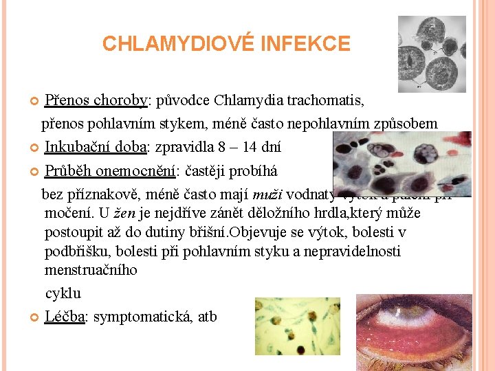 CHLAMYDIOVÉ INFEKCE Přenos choroby: původce Chlamydia trachomatis, přenos pohlavním stykem, méně často nepohlavním způsobem