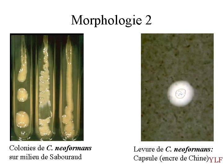 Morphologie 2 Colonies de C. neoformans sur milieu de Sabouraud Levure de C. neoformans: