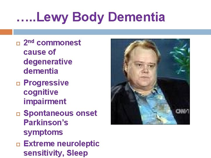 …. . Lewy Body Dementia 2 nd commonest cause of degenerative dementia Progressive cognitive …. . Lewy Body Dementia 2 nd commonest cause of degenerative dementia Progressive cognitive