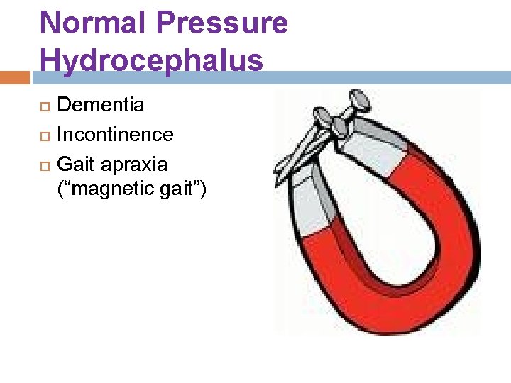Normal Pressure Hydrocephalus Dementia Incontinence Gait apraxia (“magnetic gait”) Normal Pressure Hydrocephalus Dementia Incontinence Gait apraxia (“magnetic gait”)