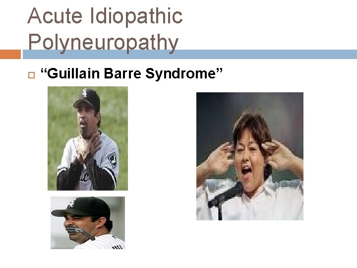 Acute Idiopathic Polyneuropathy “Guillain Barre Syndrome” Acute Idiopathic Polyneuropathy “Guillain Barre Syndrome”