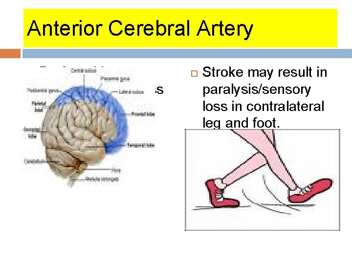 Anterior Cerebral Artery Profound lower extremity weakness (contralateral) Stroke may result in paralysis/sensory loss Anterior Cerebral Artery Profound lower extremity weakness (contralateral) Stroke may result in paralysis/sensory loss
