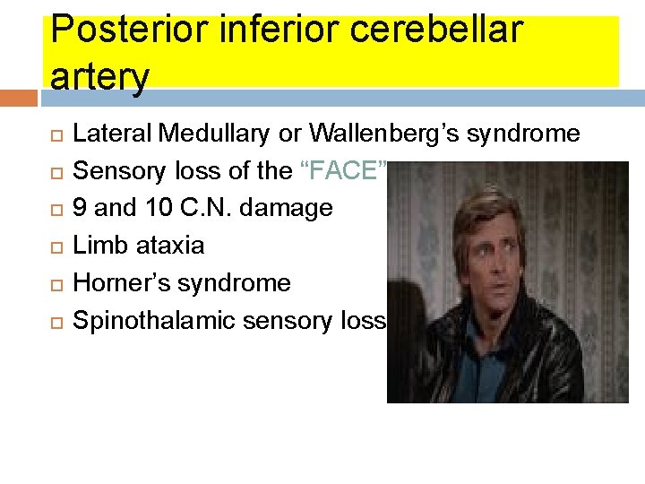 Posterior inferior cerebellar artery Lateral Medullary or Wallenberg’s syndrome Sensory loss of the “FACE” Posterior inferior cerebellar artery Lateral Medullary or Wallenberg’s syndrome Sensory loss of the “FACE”