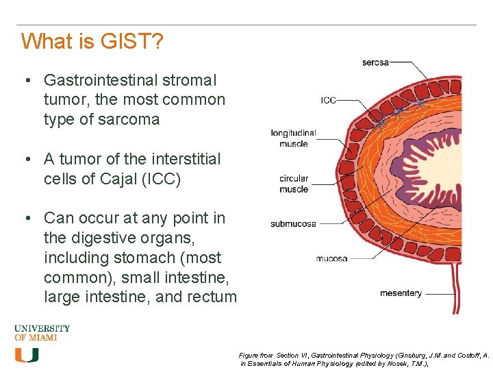 What is GIST? • Gastrointestinal stromal tumor, the most common type of sarcoma •