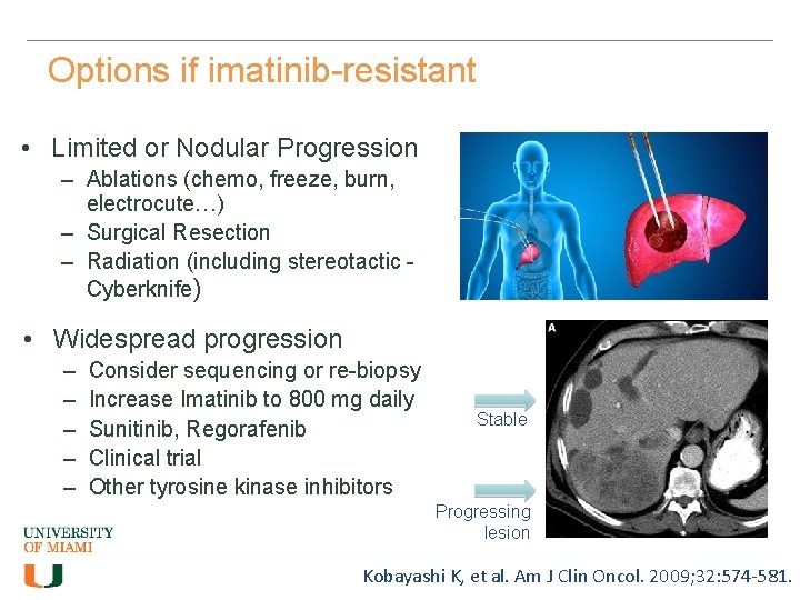 Options if imatinib-resistant • Limited or Nodular Progression – Ablations (chemo, freeze, burn, electrocute…)