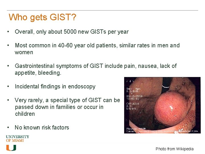 Who gets GIST? • Overall, only about 5000 new GISTs per year • Most