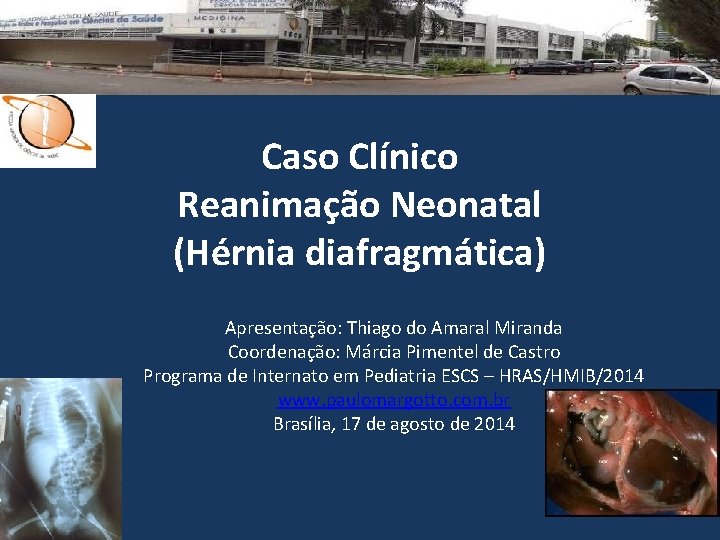 Caso Clínico Reanimação Neonatal (Hérnia diafragmática) Apresentação: Thiago do Amaral Miranda Coordenação: Márcia Pimentel