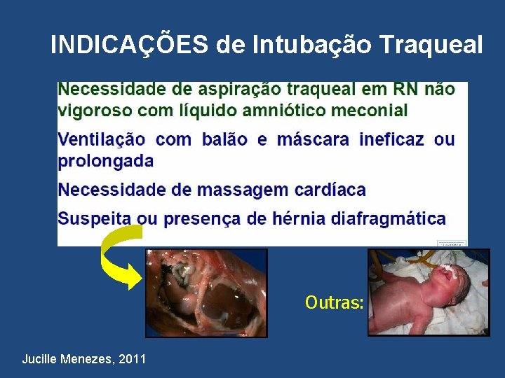 INDICAÇÕES de Intubação Traqueal Outras: Jucille Menezes, 2011 