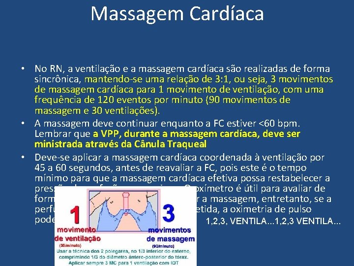 Massagem Cardíaca • No RN, a ventilação e a massagem cardíaca são realizadas de