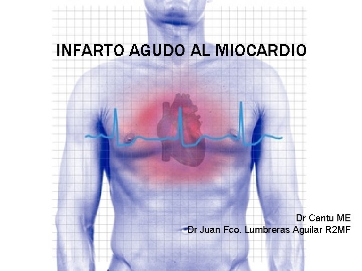INFARTO AGUDO AL MIOCARDIO Dr Cantu ME Dr Juan Fco. Lumbreras Aguilar R 2