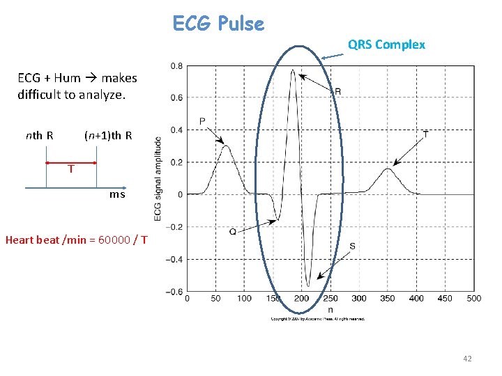 ECG Pulse QRS Complex ECG + Hum makes difficult to analyze. nth R (n+1)th
