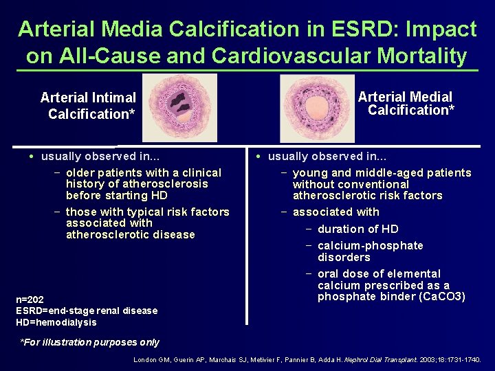 Arterial Media Calcification in ESRD: Impact on All-Cause and Cardiovascular Mortality Arterial Intimal Calcification*