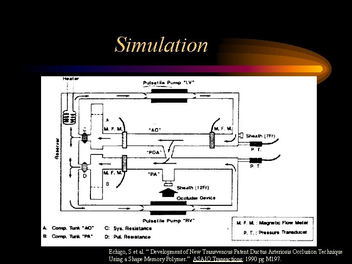 Simulation Echigo, S et al. “ Development of New Transvenous Patent Ductus Arteriosis Occlusion