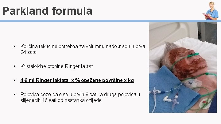 Parkland formula • Količina tekućine potrebna za volumnu nadoknadu u prva 24 sata •