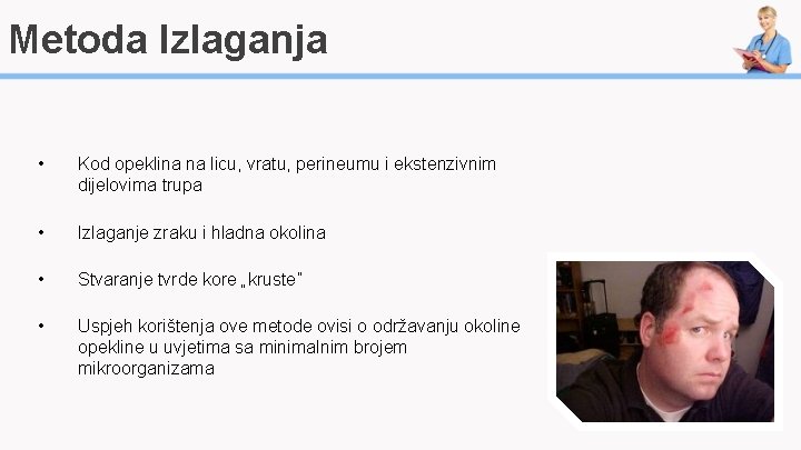 Metoda Izlaganja • Kod opeklina na licu, vratu, perineumu i ekstenzivnim dijelovima trupa •