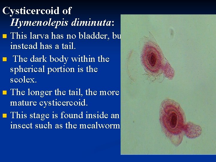 Cysticercoid of Hymenolepis diminuta: This larva has no bladder, but instead has a tail.