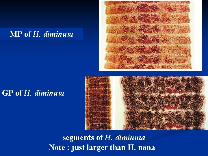 MP of H. diminuta GP of H. diminuta segments of H. diminuta Note :