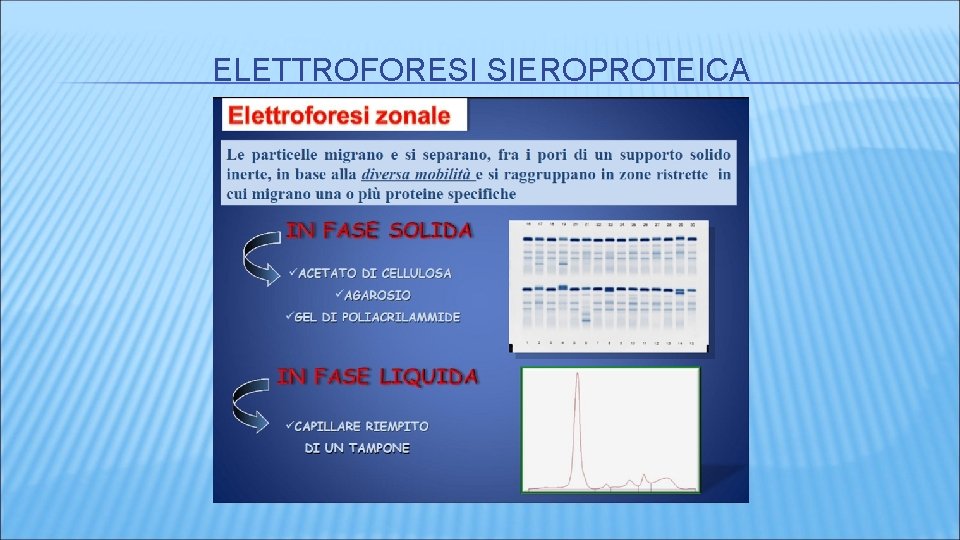 ELETTROFORESI SIEROPROTEICA ELETTROFORESI SIEROPROTEICA