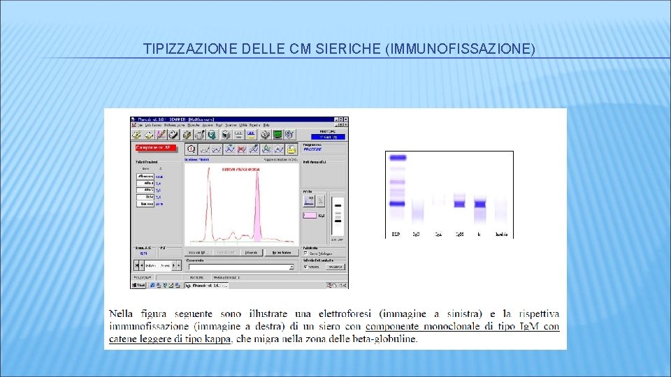 TIPIZZAZIONE DELLE CM SIERICHE (IMMUNOFISSAZIONE) TIPIZZAZIONE DELLE CM SIERICHE (IMMUNOFISSAZIONE)