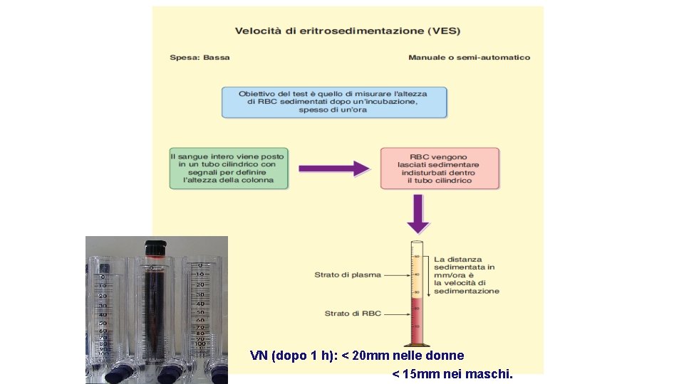 VN (dopo 1 h): < 20 mm nelle donne < 15 mm nei maschi. VN (dopo 1 h): < 20 mm nelle donne < 15 mm nei maschi.