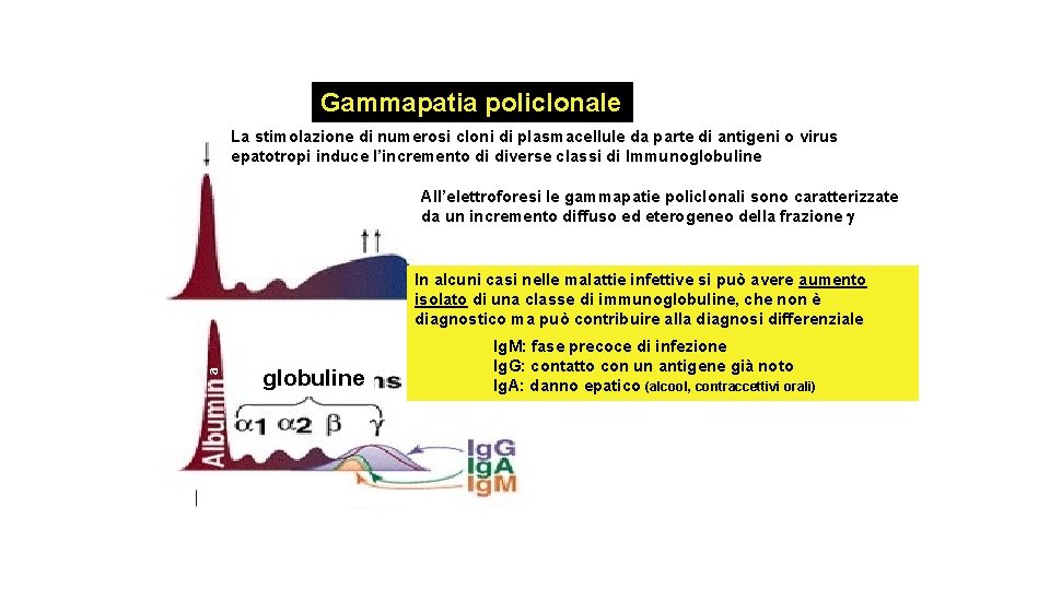 Gammapatia policlonale La stimolazione di numerosi cloni di plasmacellule da parte di antigeni o Gammapatia policlonale La stimolazione di numerosi cloni di plasmacellule da parte di antigeni o