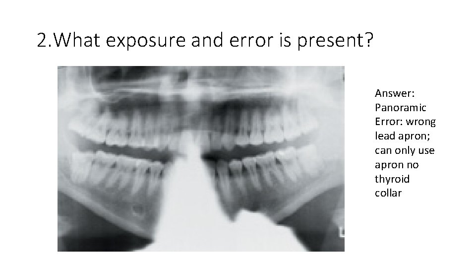 2. What exposure and error is present? Answer: Panoramic Error: wrong lead apron; can