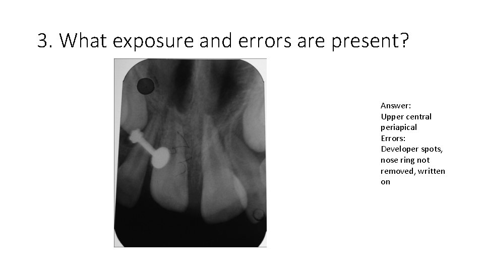 3. What exposure and errors are present? Answer: Upper central periapical Errors: Developer spots,