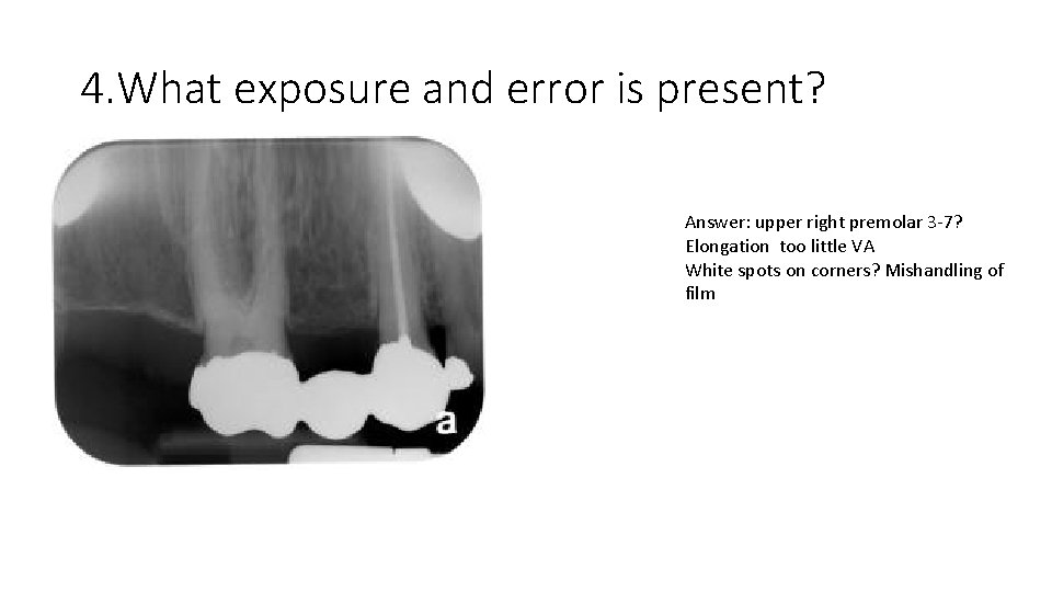 4. What exposure and error is present? Answer: upper right premolar 3 -7? Elongation