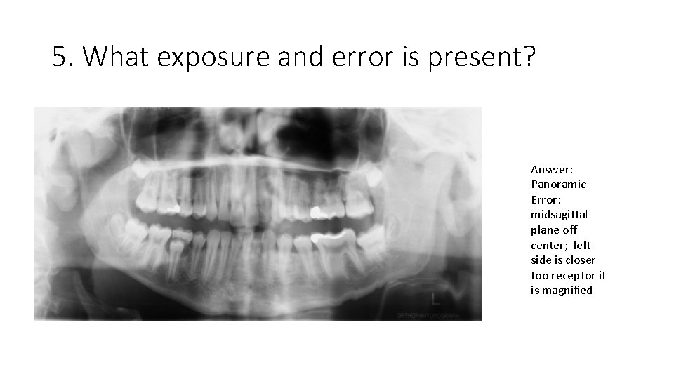 5. What exposure and error is present? Answer: Panoramic Error: midsagittal plane off center;