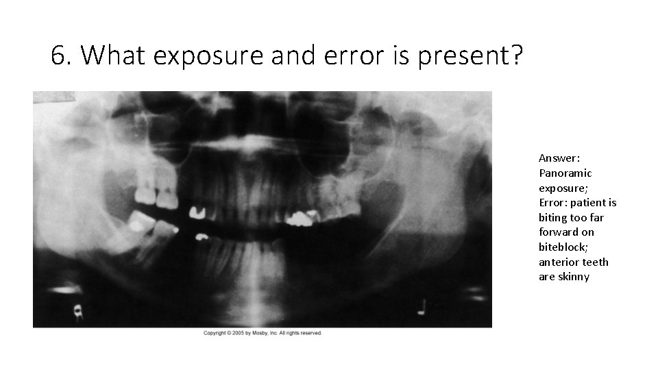 6. What exposure and error is present? Answer: Panoramic exposure; Error: patient is biting