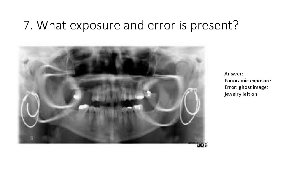 7. What exposure and error is present? Answer: Panoramic exposure Error: ghost image; jewelry