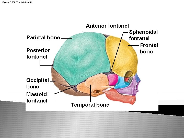 Figure 5. 15 b The fetal skull. Parietal bone Posterior fontanel Occipital bone Mastoid