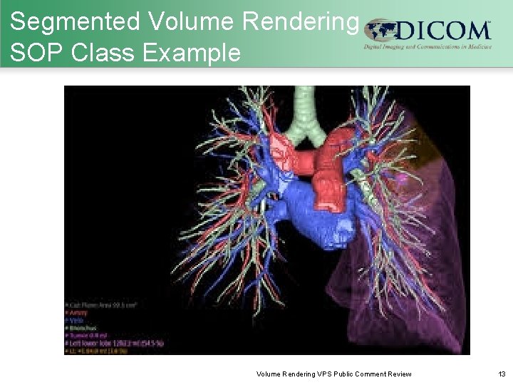Volume Rendering Volumetric Presentation State Supplement 190 Public