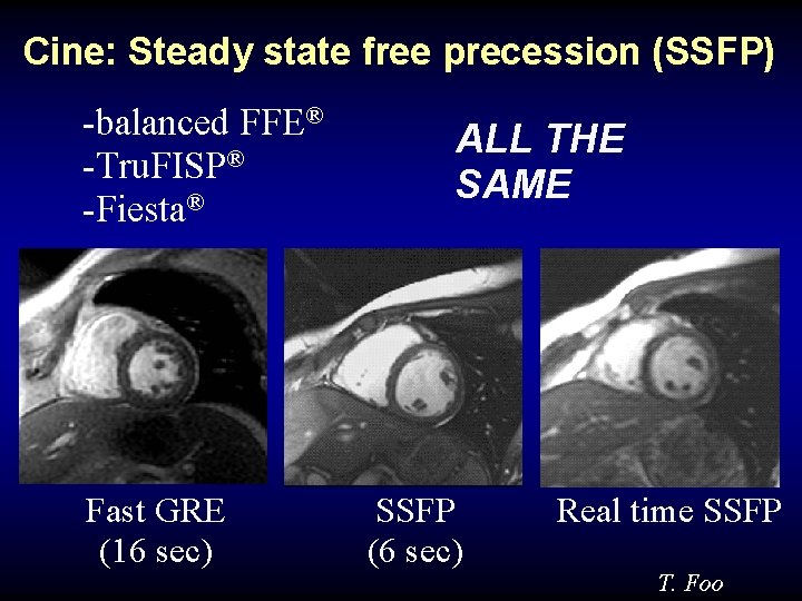 Cine: Steady state free precession (SSFP) -balanced FFE® -Tru. FISP® -Fiesta® Fast GRE (16