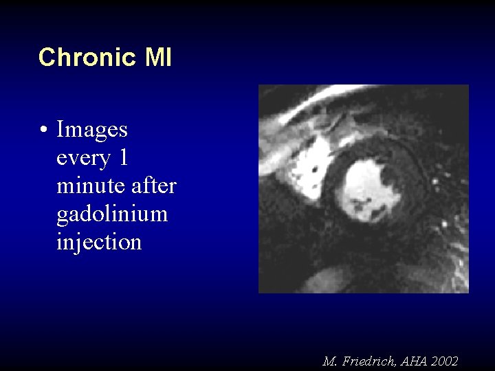 Chronic MI • Images every 1 minute after gadolinium injection M. Friedrich, AHA 2002