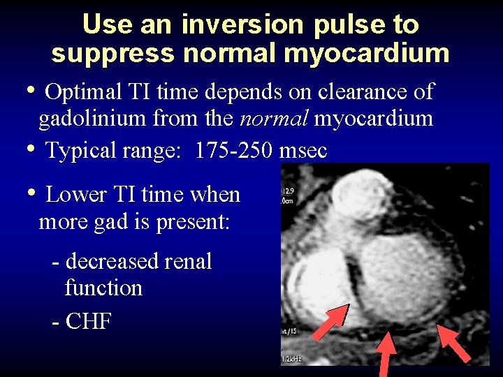 Use an inversion pulse to suppress normal myocardium • Optimal TI time depends on
