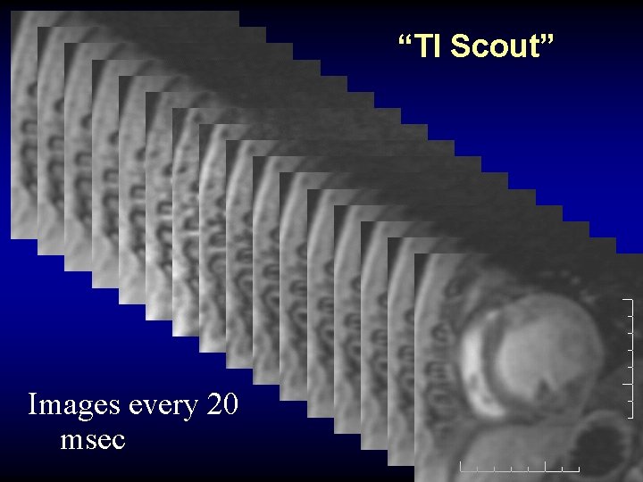 “TI Scout” Images every 20 msec 