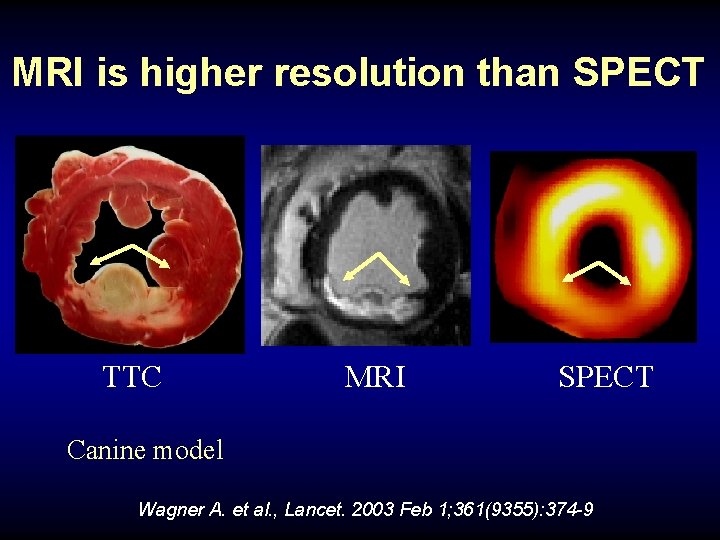 MRI is higher resolution than SPECT TTC MRI SPECT Canine model Wagner A. et