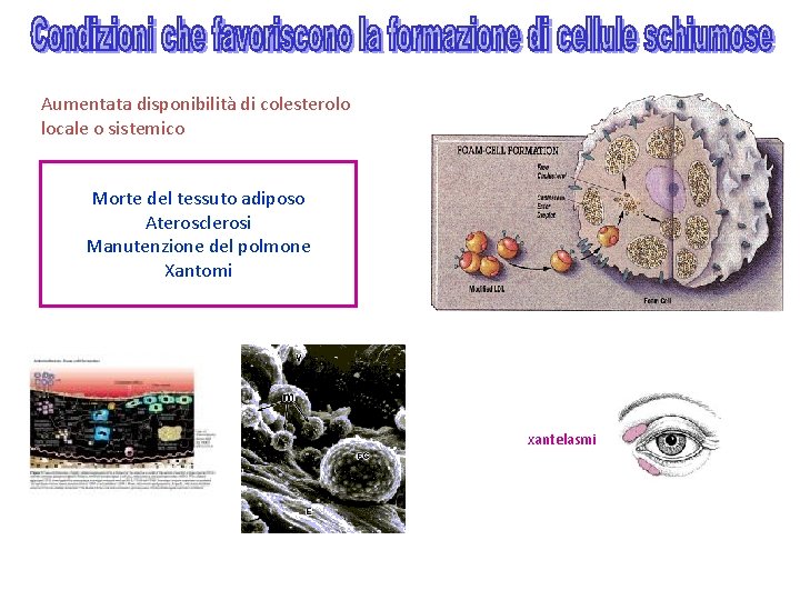 Aumentata disponibilità di colesterolo locale o sistemico Morte del tessuto adiposo Aterosclerosi Manutenzione del