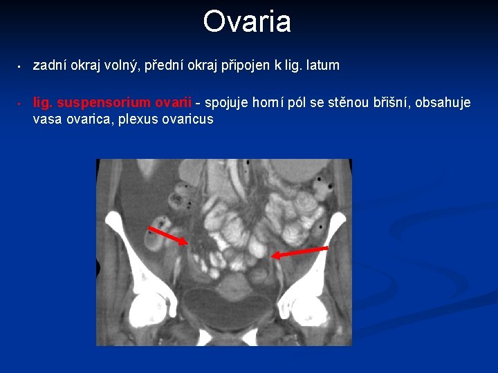 Ovaria • zadní okraj volný, přední okraj připojen k lig. latum • lig. suspensorium