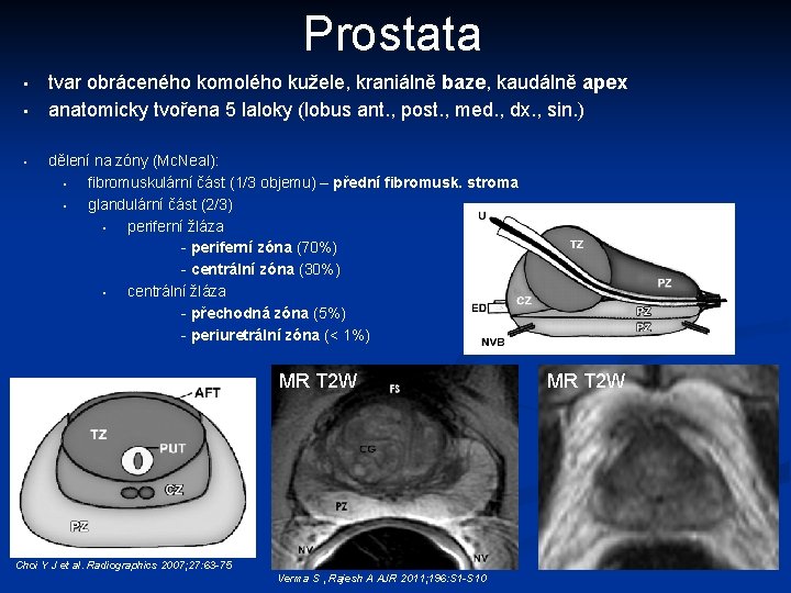 Prostata • • • tvar obráceného komolého kužele, kraniálně baze, kaudálně apex anatomicky tvořena