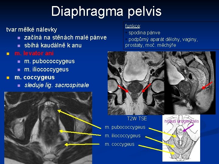 Diaphragma pelvis tvar mělké nálevky n začíná na stěnách malé pánve n sbíhá kaudálně