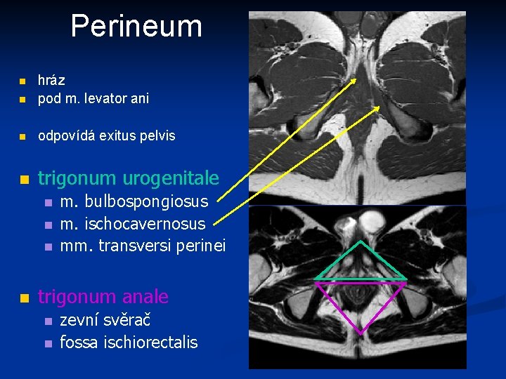 Perineum n hráz pod m. levator ani n odpovídá exitus pelvis n trigonum urogenitale