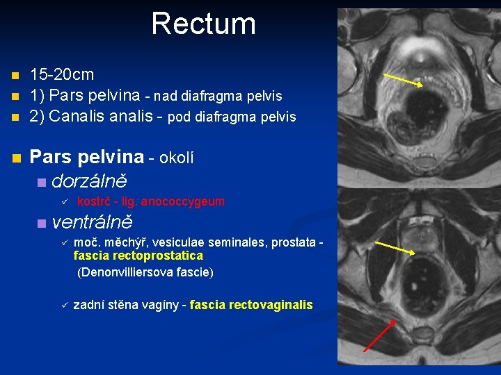 Rectum n n 15 -20 cm 1) Pars pelvina - nad diafragma pelvis 2)