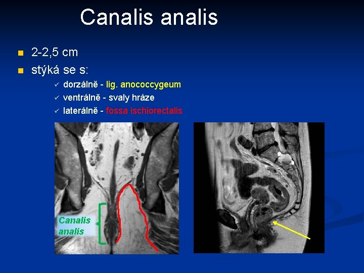 Canalis n n 2 -2, 5 cm stýká se s: dorzálně - lig. anococcygeum
