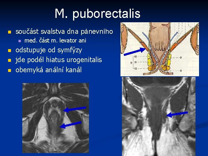 M. puborectalis n součást svalstva dna pánevního n n med. část m. levator ani