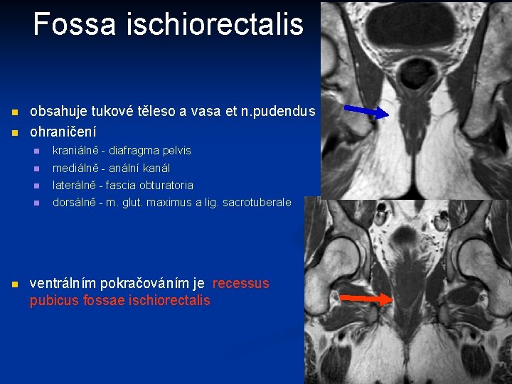 Fossa ischiorectalis n n n obsahuje tukové těleso a vasa et n. pudendus ohraničení