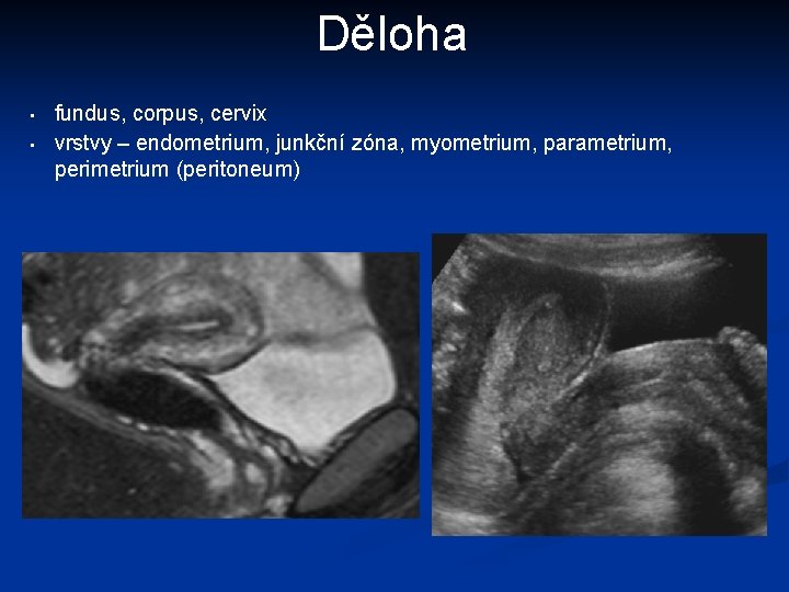 Děloha • • fundus, corpus, cervix vrstvy – endometrium, junkční zóna, myometrium, parametrium, perimetrium