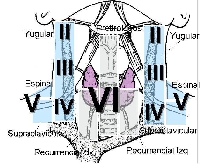 Yugular Espinal II III V IV Pretiroideos VI Supraclavicular Recurrencial dx II III Yugular