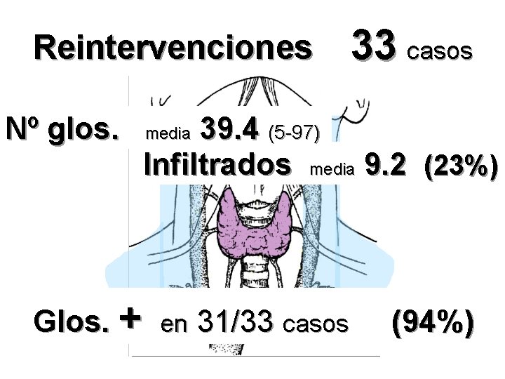 Reintervenciones Nº glos. 33 casos 39. 4 (5 -97) Infiltrados media 9. 2 (23%)